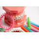 Rubber bands for braces (elastics), ligatures