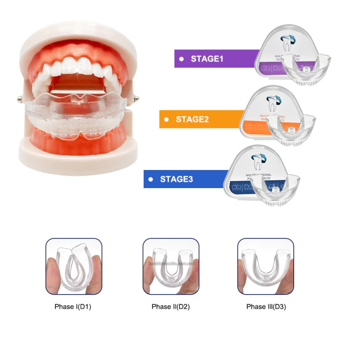 Appareil Dentaire Ortho Dents Alignement Braces Trainer T4A/T4B/T4K - Pour Enfants Et Adultes
